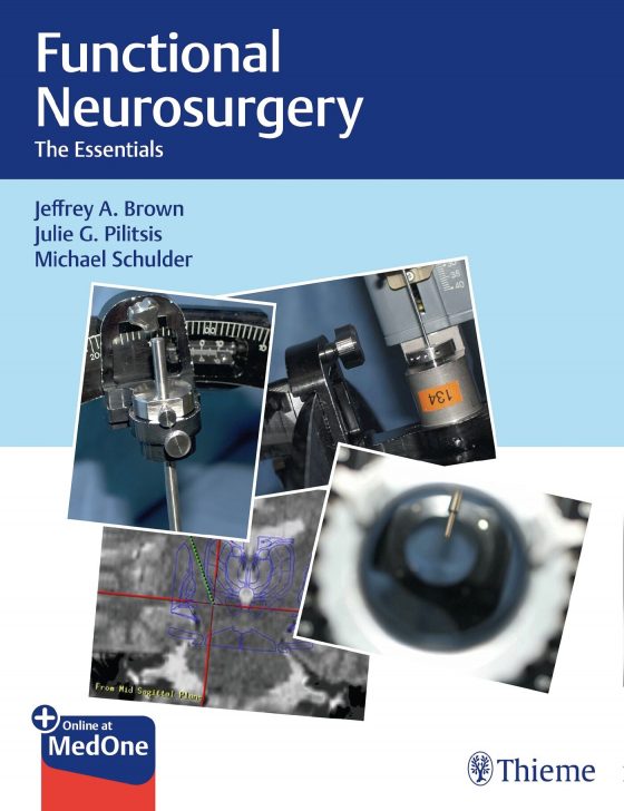 Functional Neurosurgery Original PDF