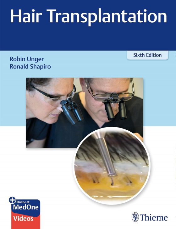 Hair Transplantation Original PDF