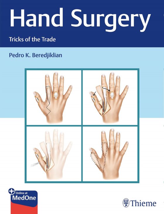 Hand Surgery Original PDF