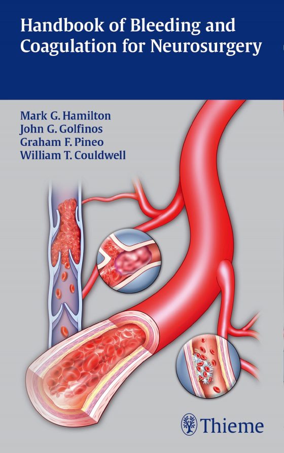 Handbook of Bleeding and Coagulation for Neurosurgery Original PDF