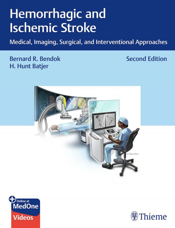 Hemorrhagic and Ischemic Stroke Original PDF