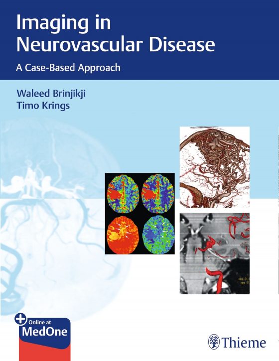 Imaging in Neurovascular Disease Original PDF