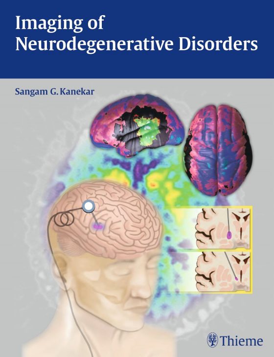 Imaging of Neurodegenerative Disorders Original PDF