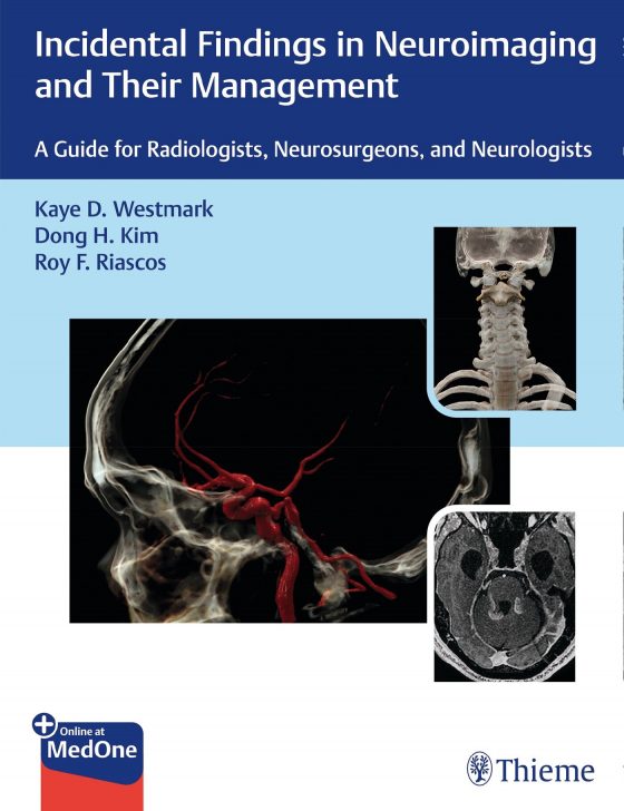 Incidental Findings in Neuroimaging and Their Management Original PDF