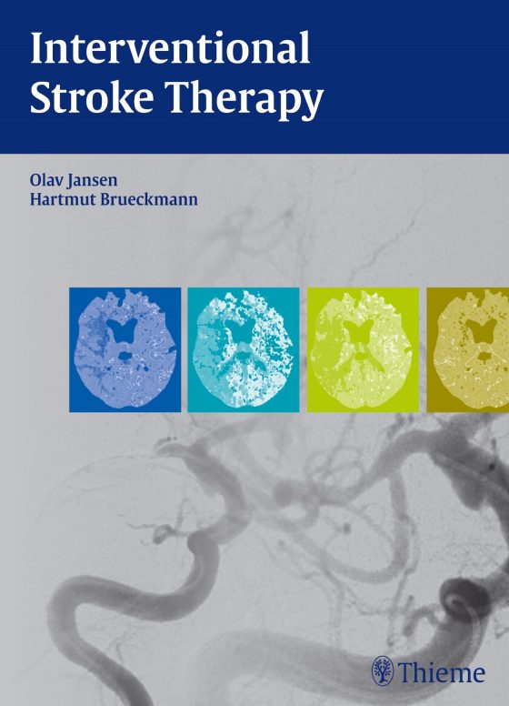 Interventional Stroke Therapy Original PDF