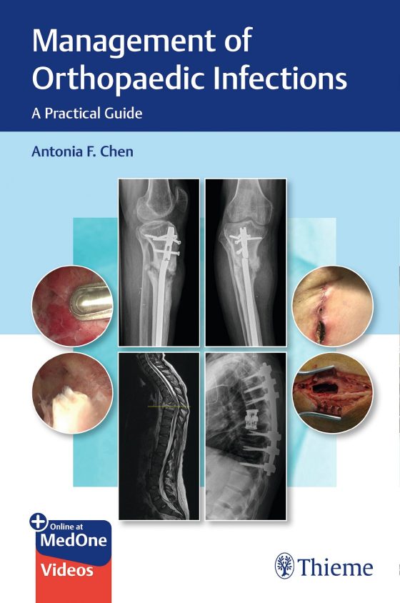 Management of Orthopaedic Infections Original PDF