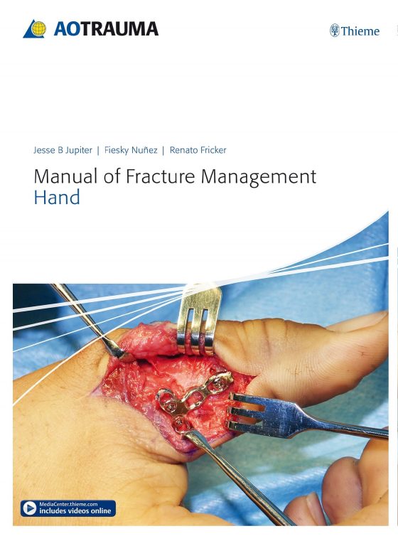 Manual of Fracture Management - Hand Original PDF