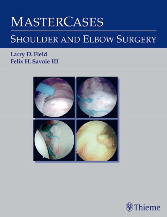 MasterCases in Shoulder and Elbow Surgery Original PDF