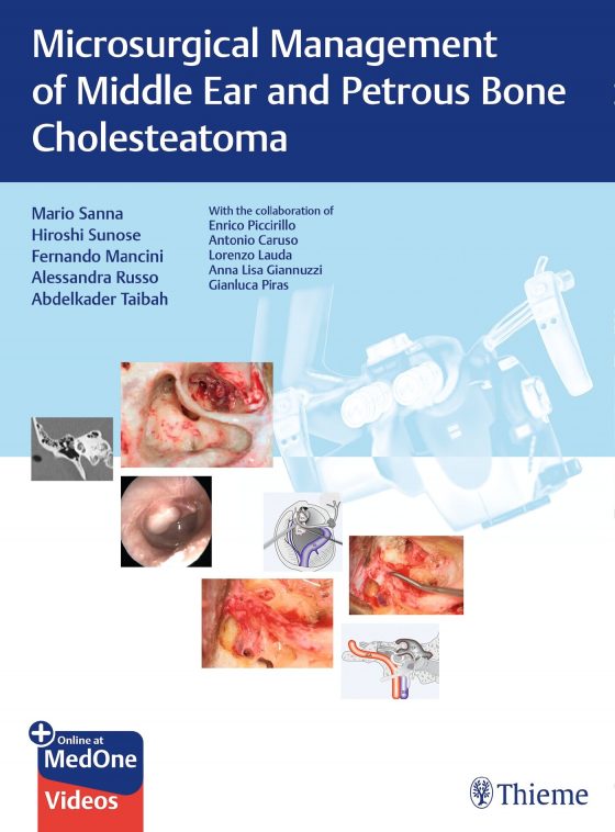 Microsurgical Management of Middle Ear and Petrous Bone Cholesteatoma Original PDF