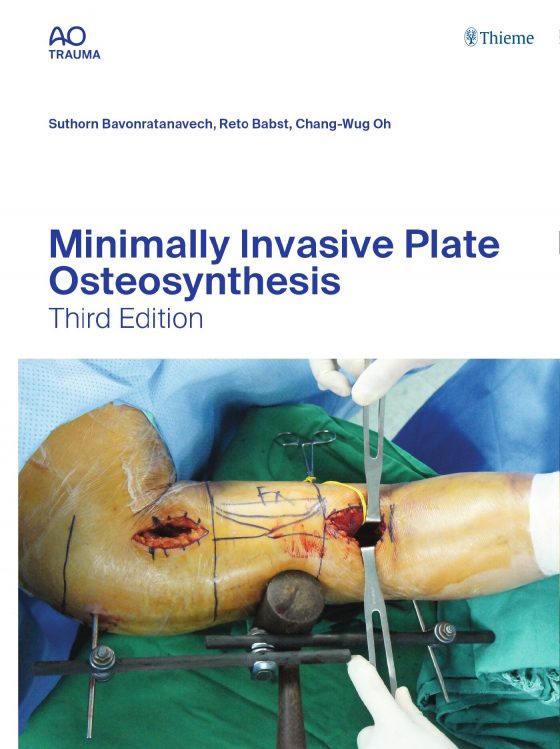 Minimally Invasive Plate Osteosynthesis Original PDF