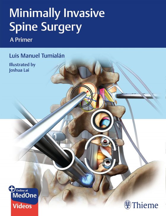 Minimally Invasive Spine Surgery Original PDF