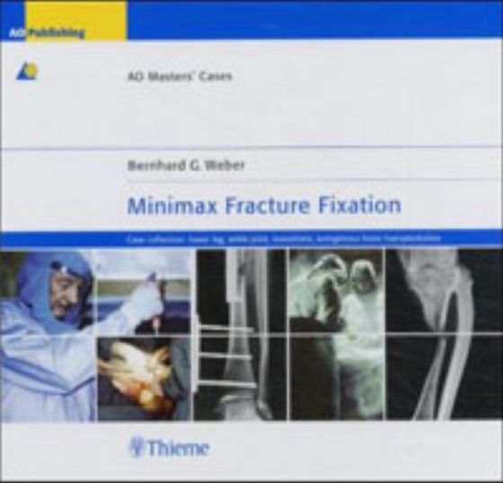 Minimax Fracture Fixation Original PDF