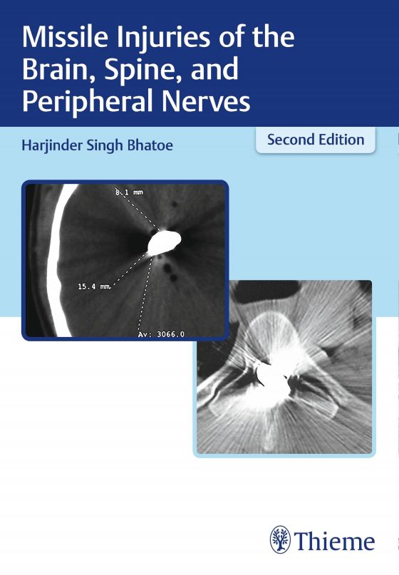 Missile Injuries of the Brain, Spine, and Peripheral Nerves Original PDF