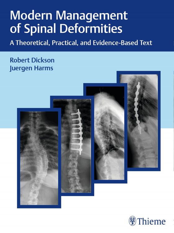 Modern Management of Spinal Deformities Original PDF