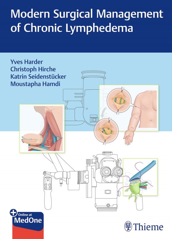 Modern Surgical Management of Chronic Lymphedema Original PDF