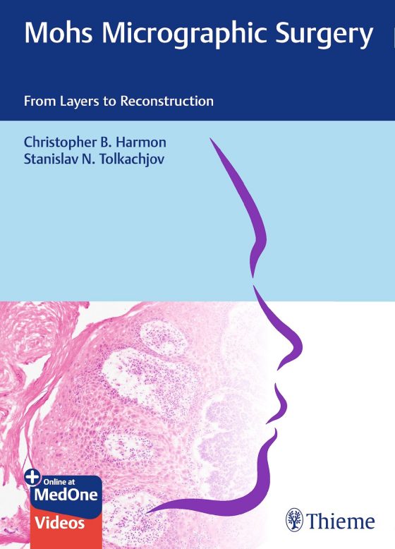 Mohs Micrographic Surgery: From Layers to Reconstruction Original PDF