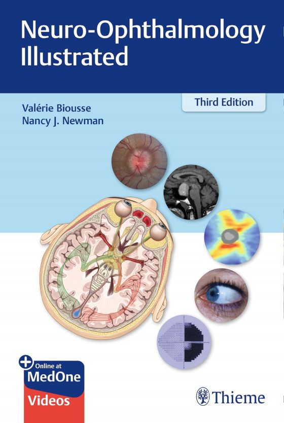 Neuro-Ophthalmology Illustrated Original PDF