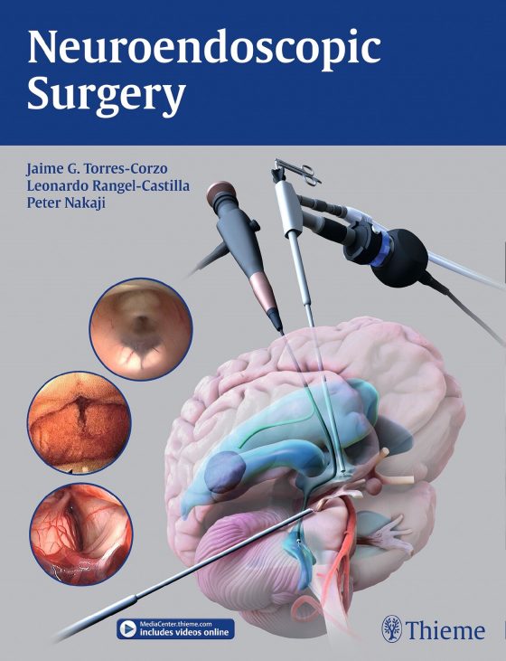 Neuroendoscopic Surgery Original PDF