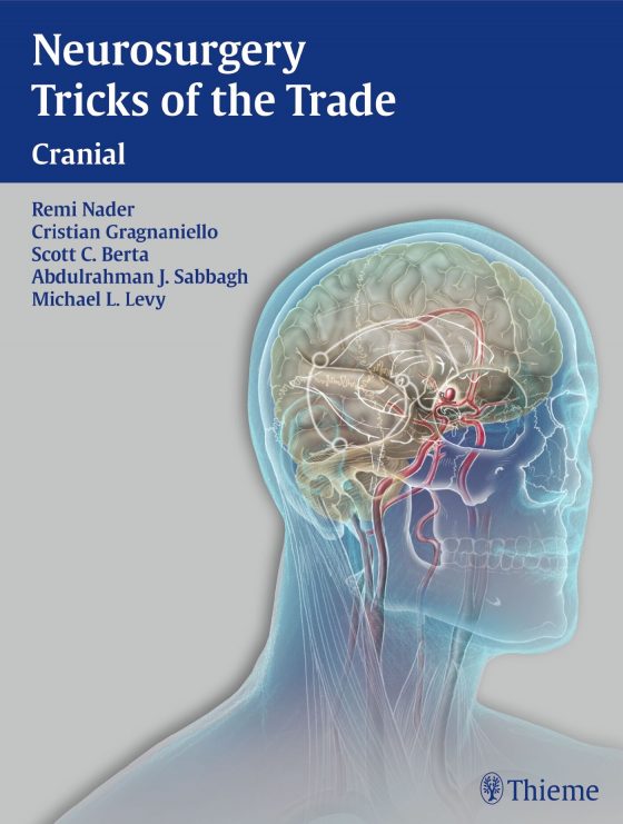 Neurosurgery Tricks of the Trade - Cranial Original PDF