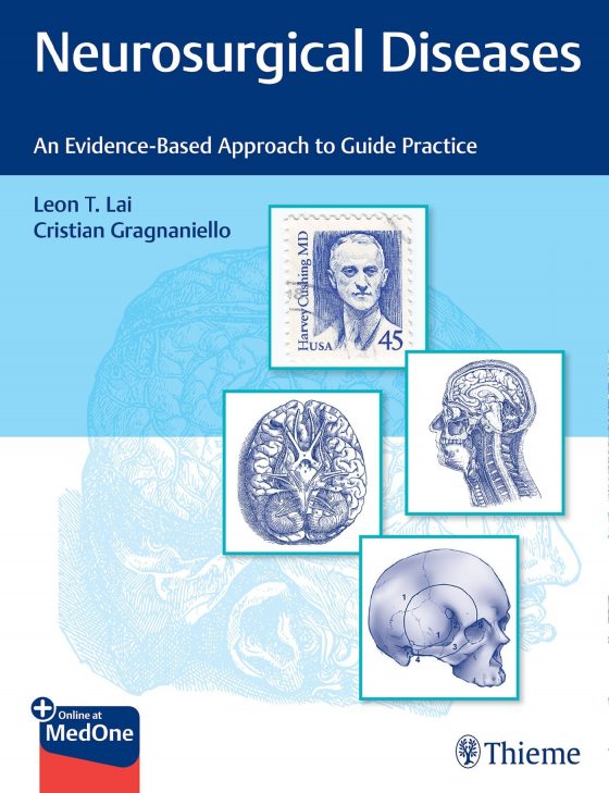 Neurosurgical Diseases Original PDF