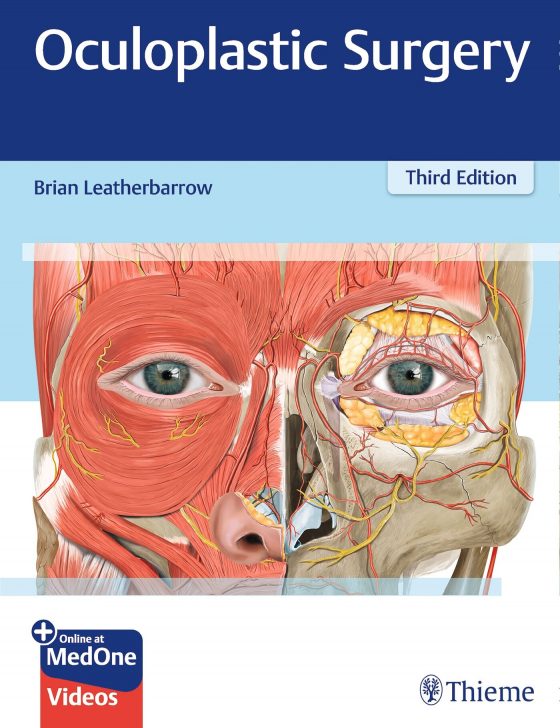 Oculoplastic Surgery Original PDF