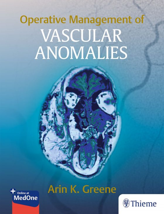 Operative Management of Vascular Anomalies Original PDF