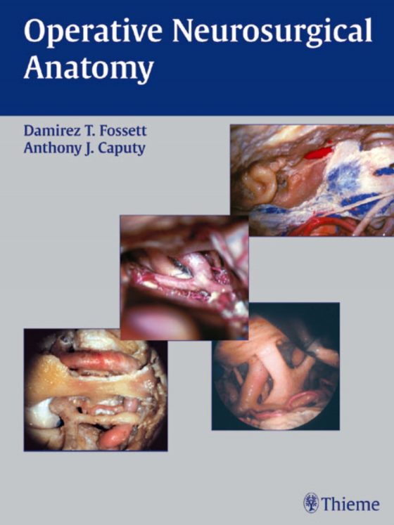 Operative Neurosurgical Anatomy Original PDF