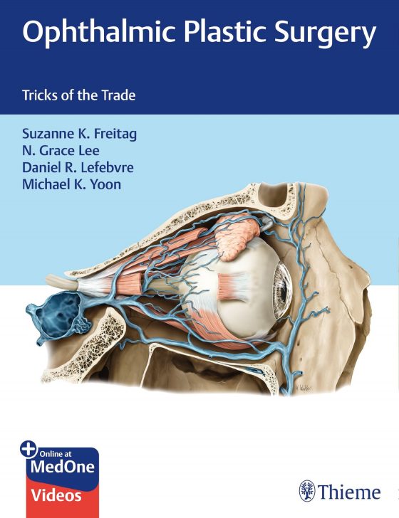 Ophthalmic Plastic Surgery Original PDF