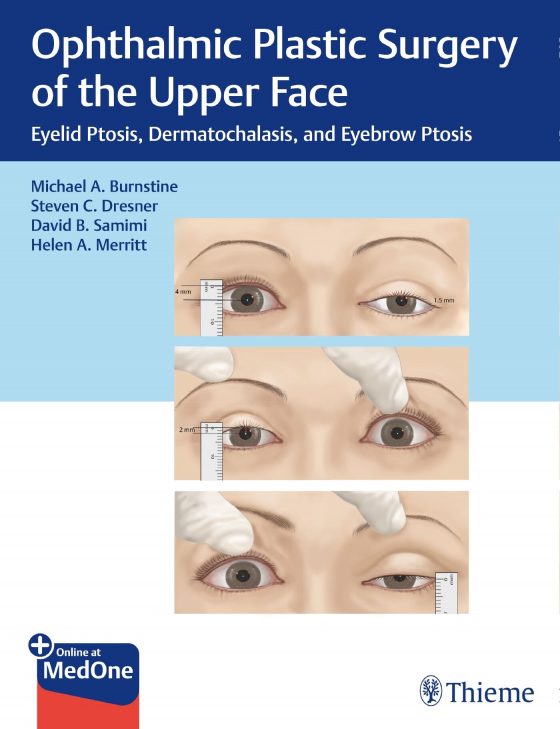 Ophthalmic Plastic Surgery of the Upper Face Original PDF