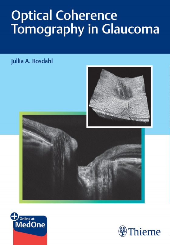 Optical Coherence Tomography in Glaucoma Original PDF