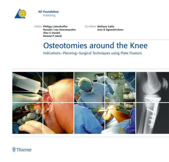 Osteotomies around the Knee Original PDF