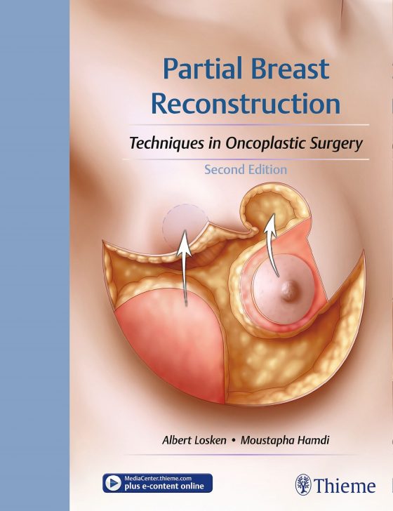 Partial Breast Reconstruction Original PDF