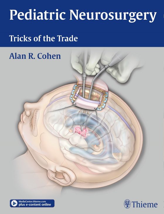 Pediatric Neurosurgery: Tricks of the Trade Original PDF