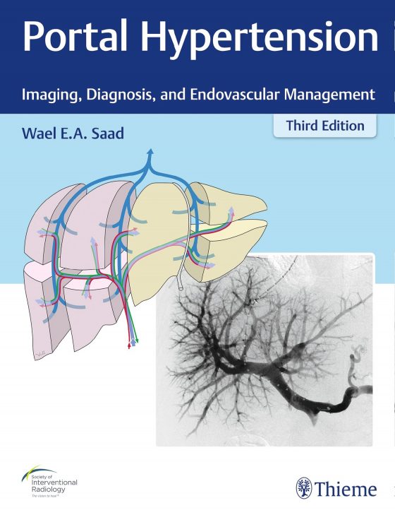 Portal Hypertension Original PDF