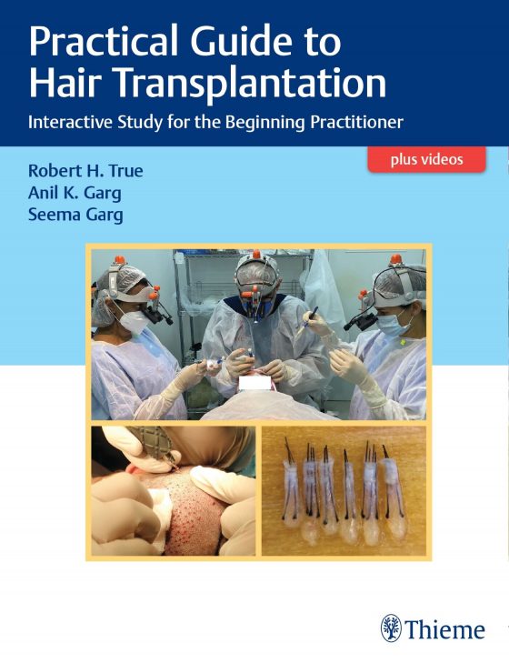 Practical Guide to Hair Transplantation Original PDF