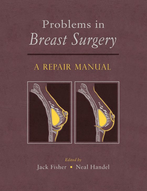 Problems in Breast Surgery Original PDF