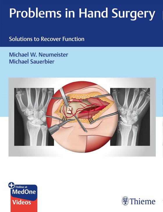 Problems in Hand Surgery Original PDF