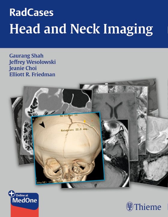 RadCases Head and Neck Imaging Original PDF