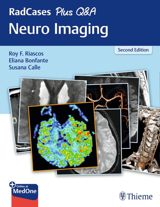 RadCases Plus Q&A Neuro Imaging Original PDF
