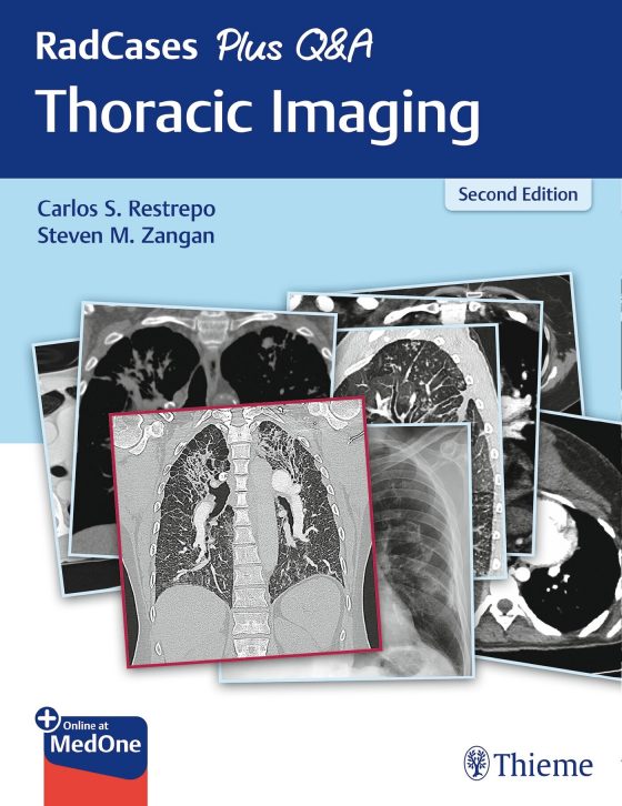 RadCases Plus Q&A Thoracic Imaging Original PDF