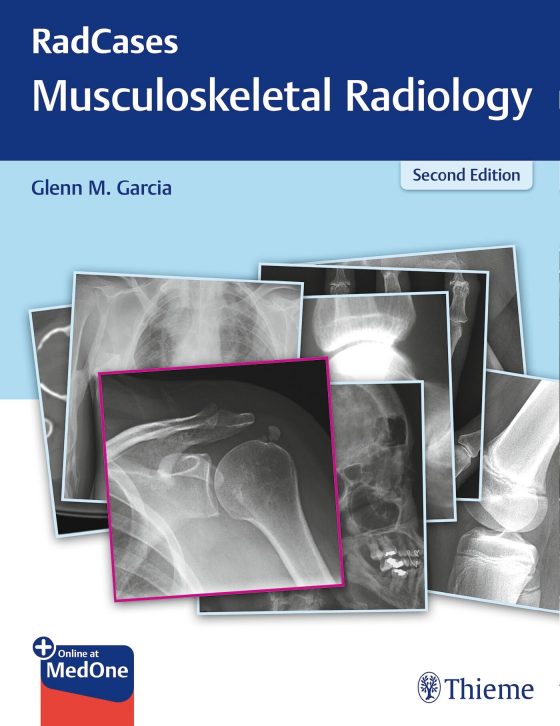 RadCases Q&A Musculoskeletal Radiology Original PDF