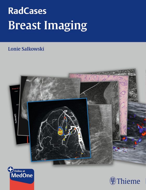 Radcases Breast Imaging Original PDF