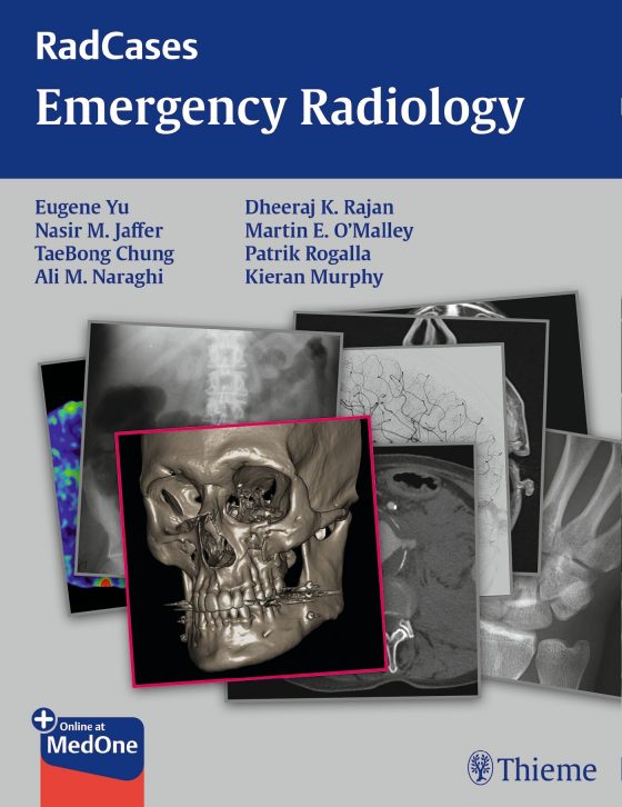 Radcases Emergency Radiology Original PDF