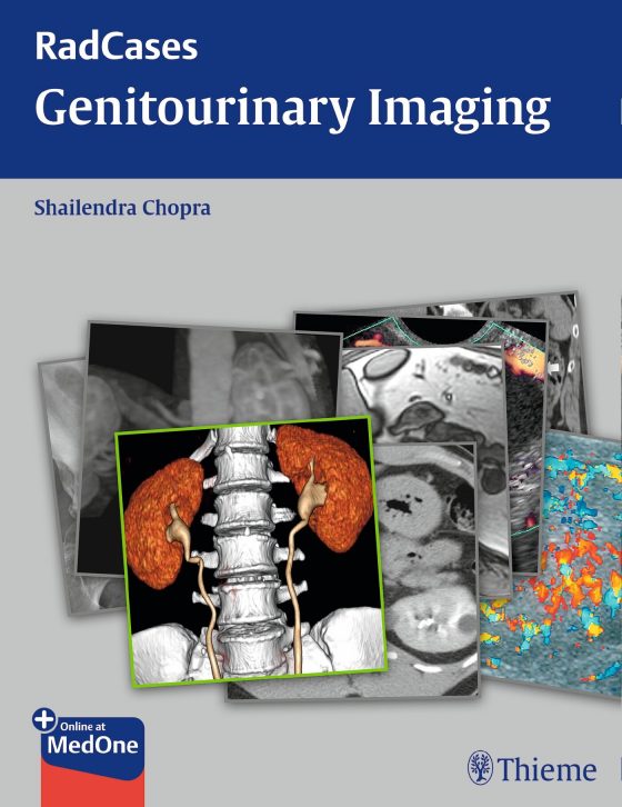 Radcases Genitourinary Imaging Original PDF