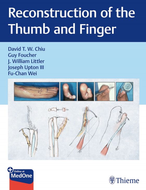 Reconstruction of the Thumb and Finger Original PDF