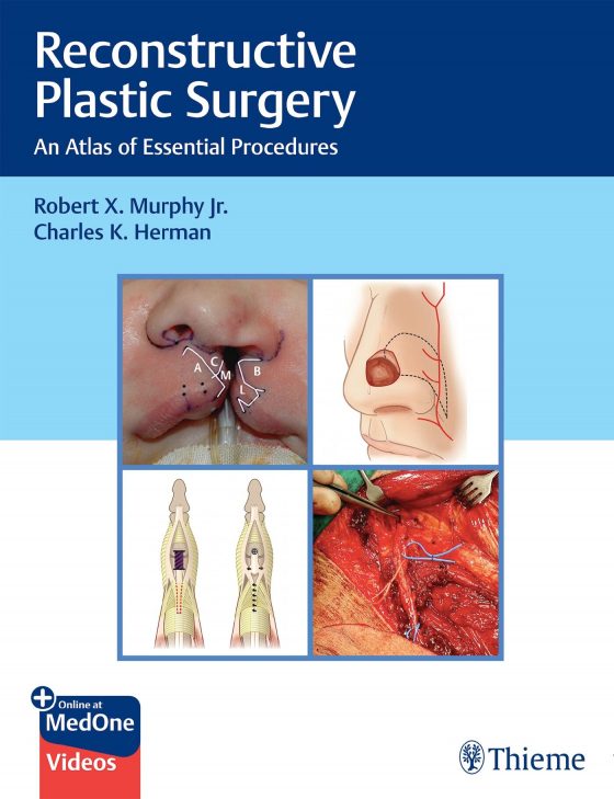 Reconstructive Plastic Surgery Original PDF
