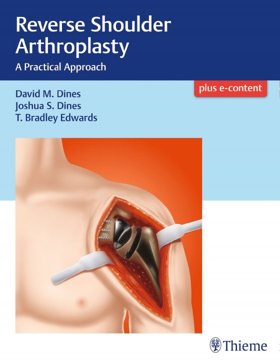 Reverse Shoulder Arthroplasty Original PDF