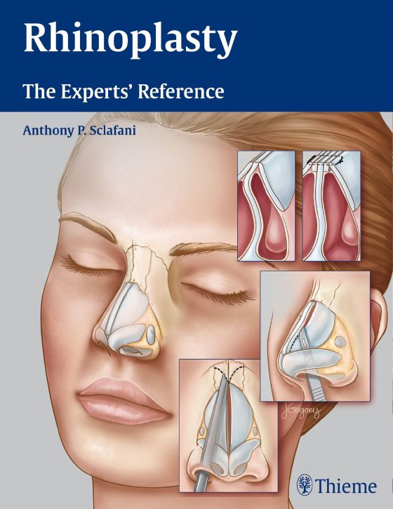 Rhinoplasty Original PDF