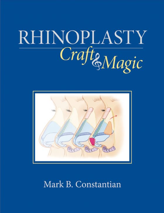 Rhinoplasty Original PDF