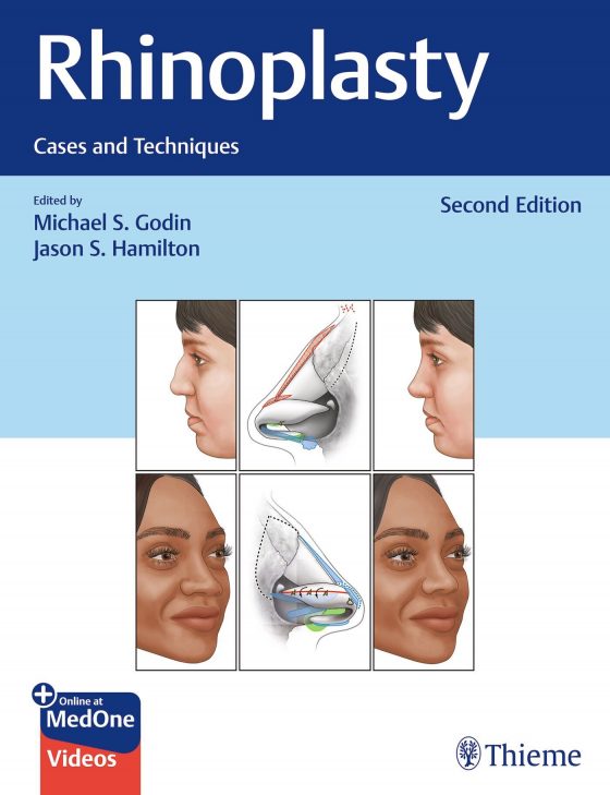 Rhinoplasty Original PDF